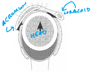 shoulder impingement shoulder impingement